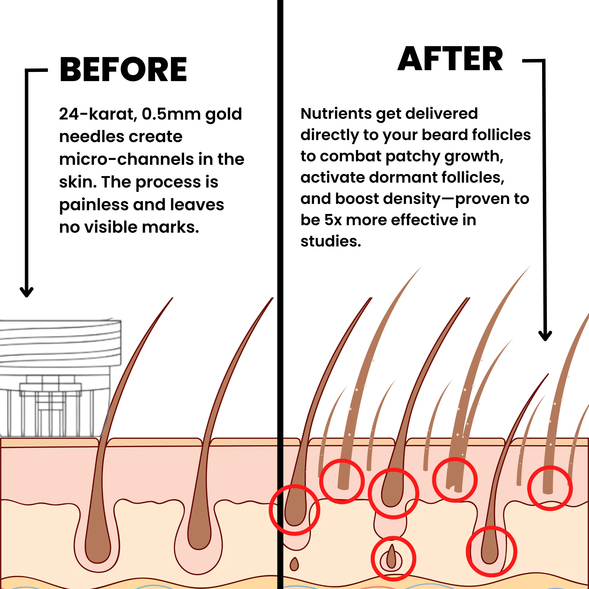 AlphaInfuse™ Beard Growth System - Image 2