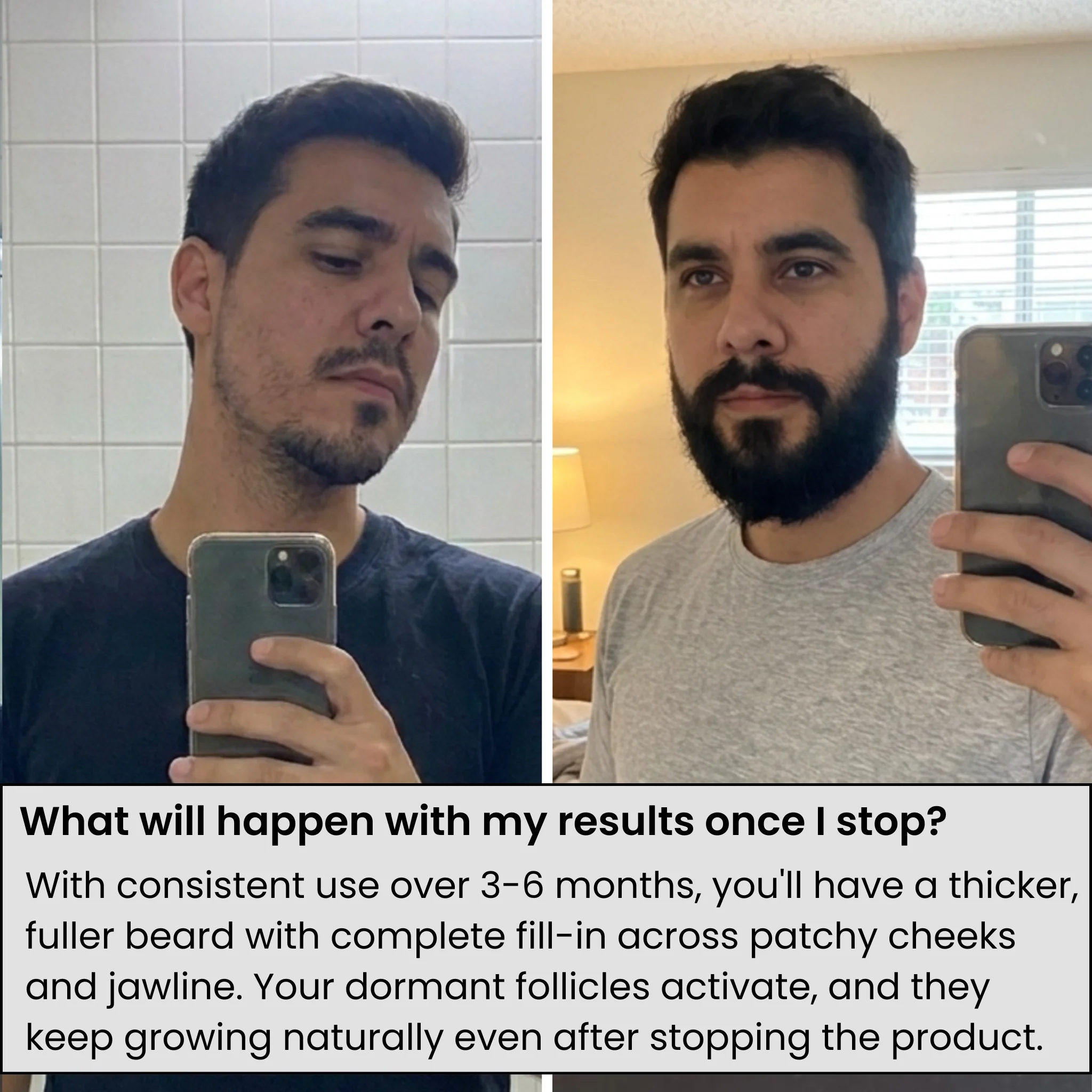AlphaInfuse™ Beard Growth System - Image 6