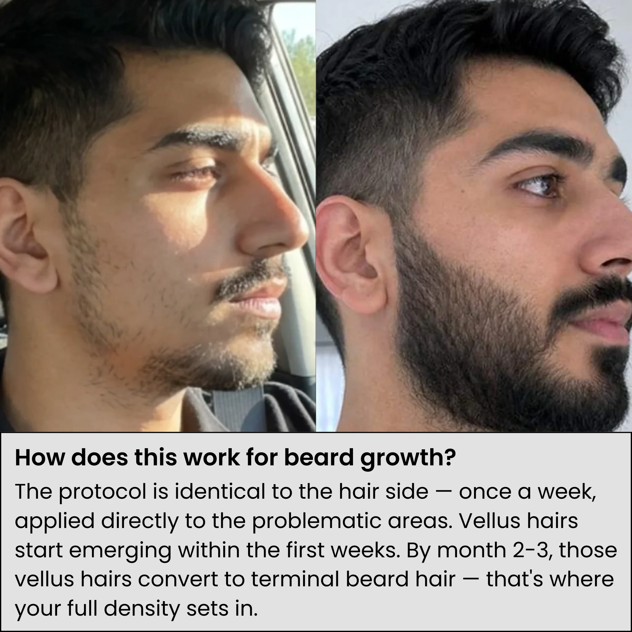 AlphaInfuse™ Hair Growth System - Image 4